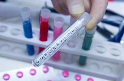 Coronavirus, aumentano le guarigioni, ad oggi sono venti: 17 quelle virali, 3 quelle cliniche