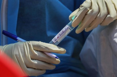 Test sierologici rapidi, da domani oltre 90.000 in distribuzione alle aziende sanitarie