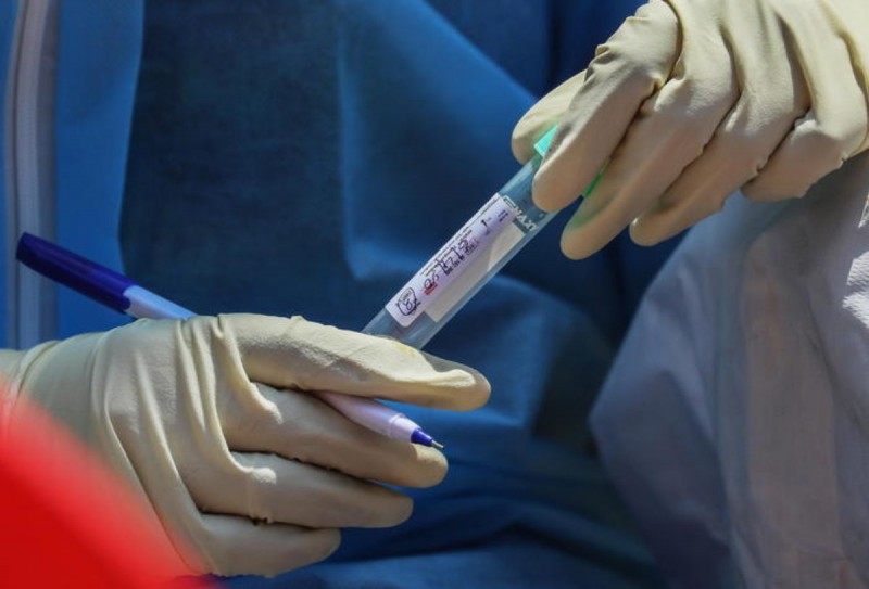 Test sierologici rapidi, da domani oltre 90.000 in distribuzione alle aziende sanitarie